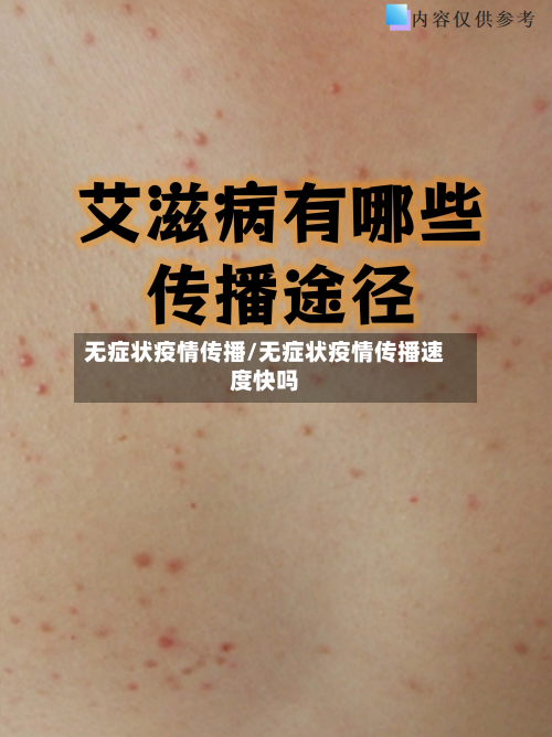 无症状疫情传播/无症状疫情传播速度快吗
